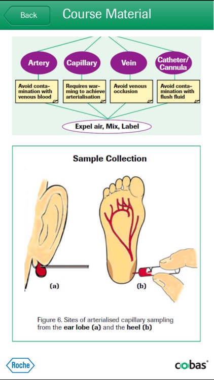 Roche Blood Gas Learn Your ABG screenshot-4