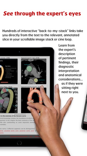 Radiology - Aortic Imaging(圖4)-速報App