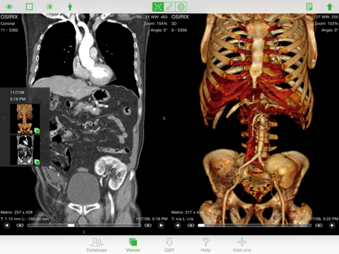 Screenshot #5 pour OsiriX HD