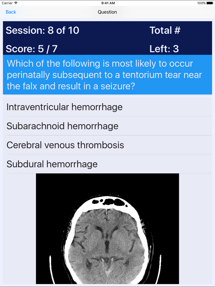 NP Neonatal Review