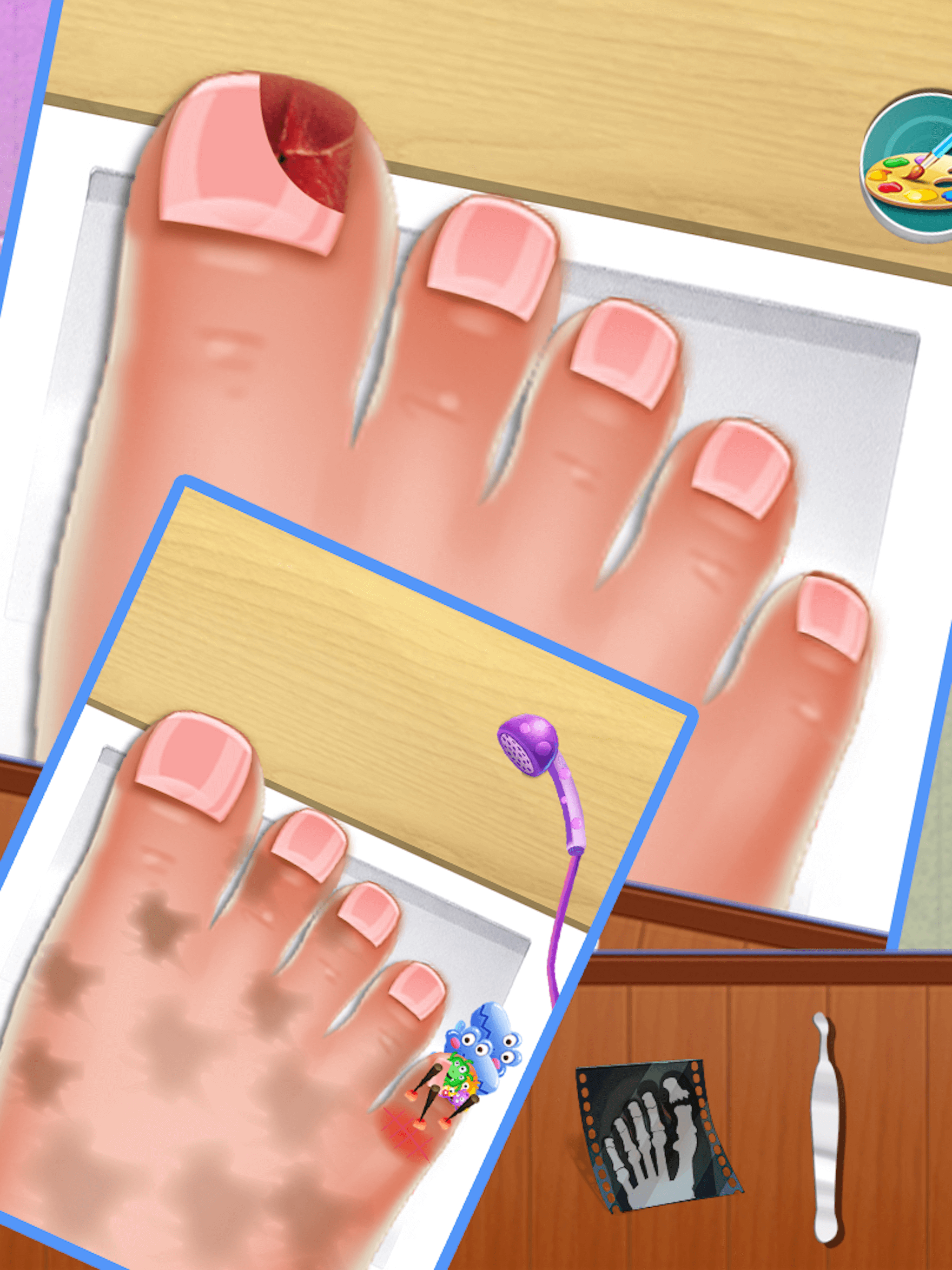 Nail doctor : Kids games toe surgery doctor games
