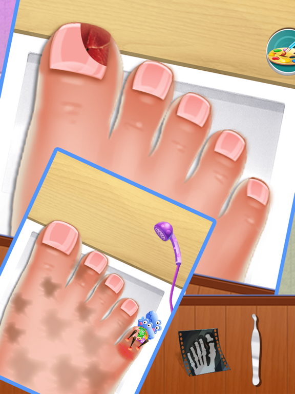 Nail doctor : Kids games toe surgery doctor games iPad screenshot