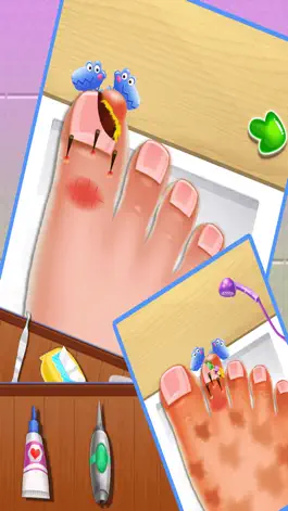 Game screenshot Nail doctor : Kids games toe surgery doctor games hack