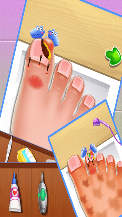Nail doctor : Kids games toe surgery doctor gamesのおすすめ画像3