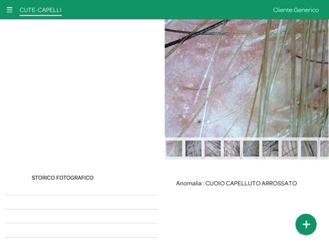 TricoRewire - náhled