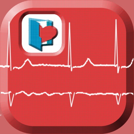 Fibrilación auricular en urgencias