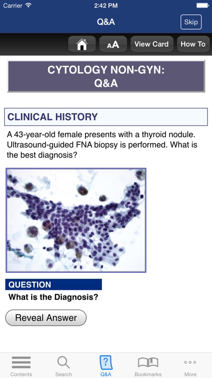 McGraw-Hill Specialty Board Review Anatomic Pathology Flashcards