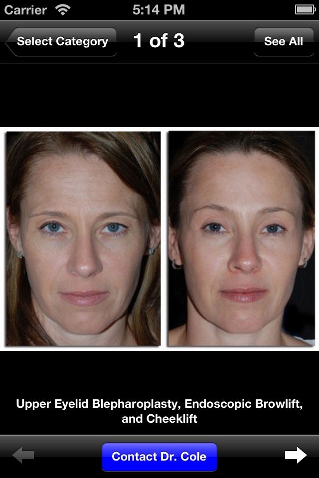 Dr. Chip Cole Atlanta Oculofacial Plastic Surgery screenshot 2