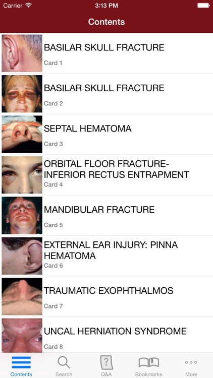 The Atlas of ER Flashcards