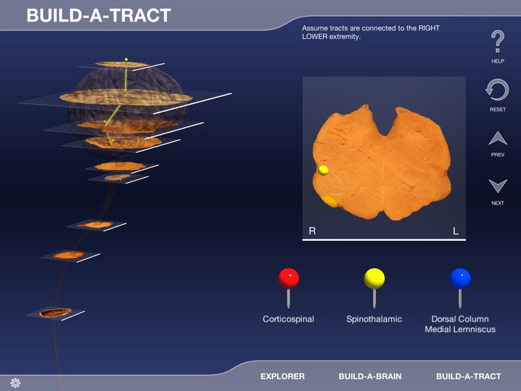 Build-A-Brain Explorer screenshot-4