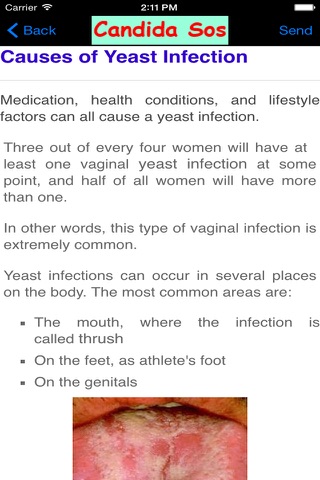 Yeast Infection Treatment- Candida Remedies screenshot 4