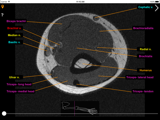 mskNAV iPad screenshot 5 - Medical app
