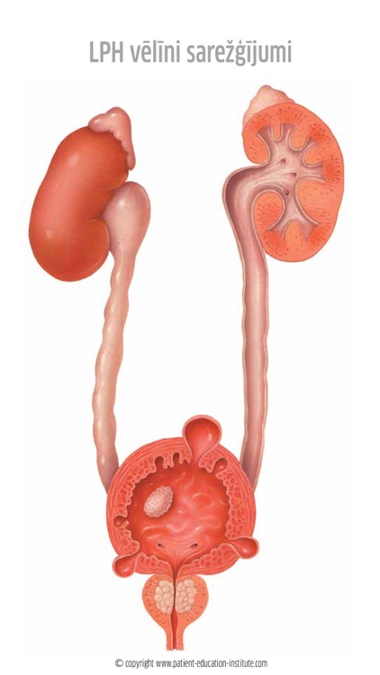 IPSEN Atlas UROLOĢIJA, phone screenshot-3