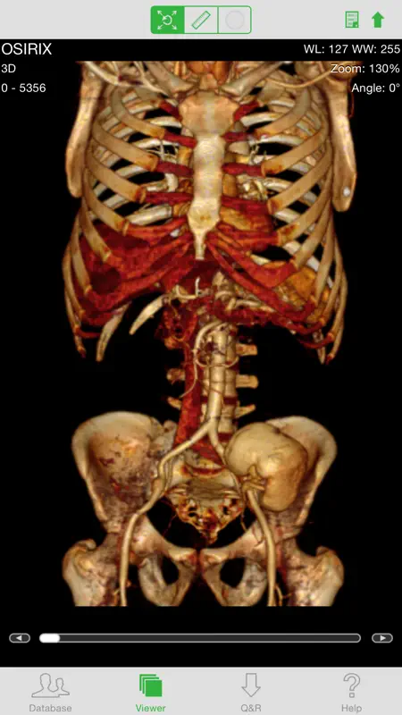 OsiriX HD screenshot 2 of 5