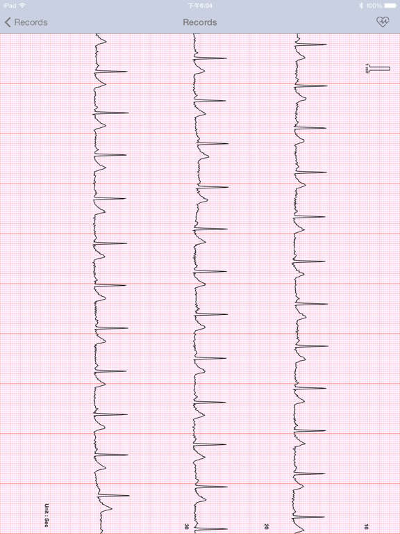 Screenshot #4 pour Sanitas ECG Manager