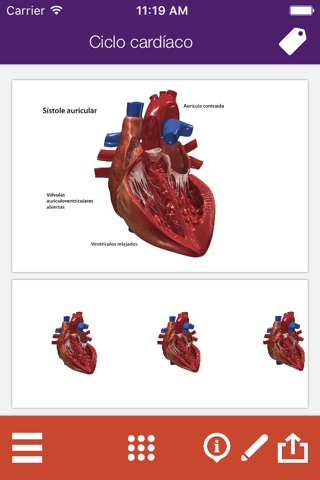 Atlas anatómico interactivo Síndrome coronario agudo screenshot 2