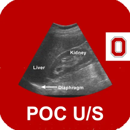 POC Ultrasound Guide Cheats