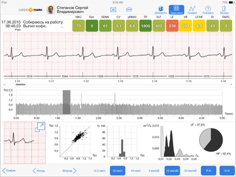 CardioQVARK Doctor screenshot 2