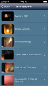 EUS - Diagnostic and Interventional Endoscopic Ultrasound screenshot #3 for iPhone