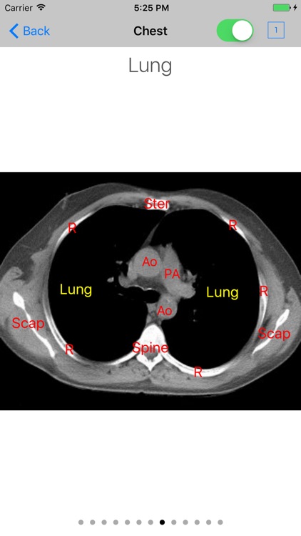 iAnatomy for Patients screenshot-4