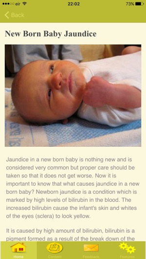 Symptoms Of Jaundice(圖1)-速報App