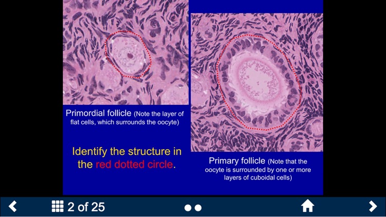 Histology - Urinary-Endocrine-Reproductive Systems screenshot-4