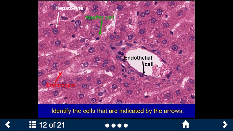 Histology – Gastrointestinal Tract screenshot-4