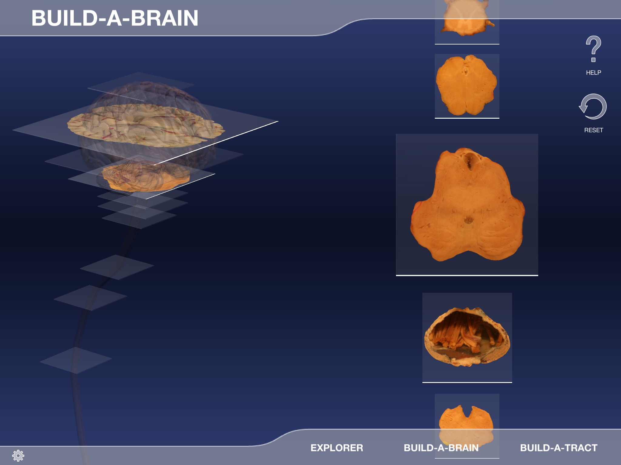 Build-A-Brain Explorer screenshot 4