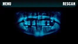 Game screenshot Simulator X-ray Teeth Prank apk