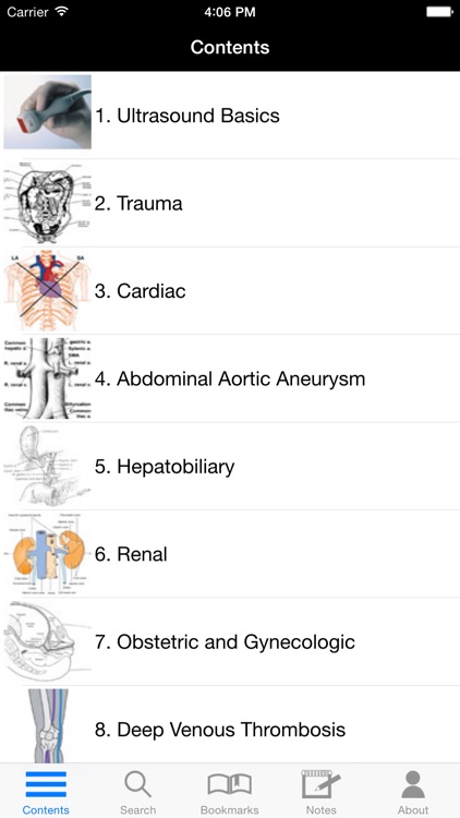 Pocket Atlas of Emergency Ultrasound
