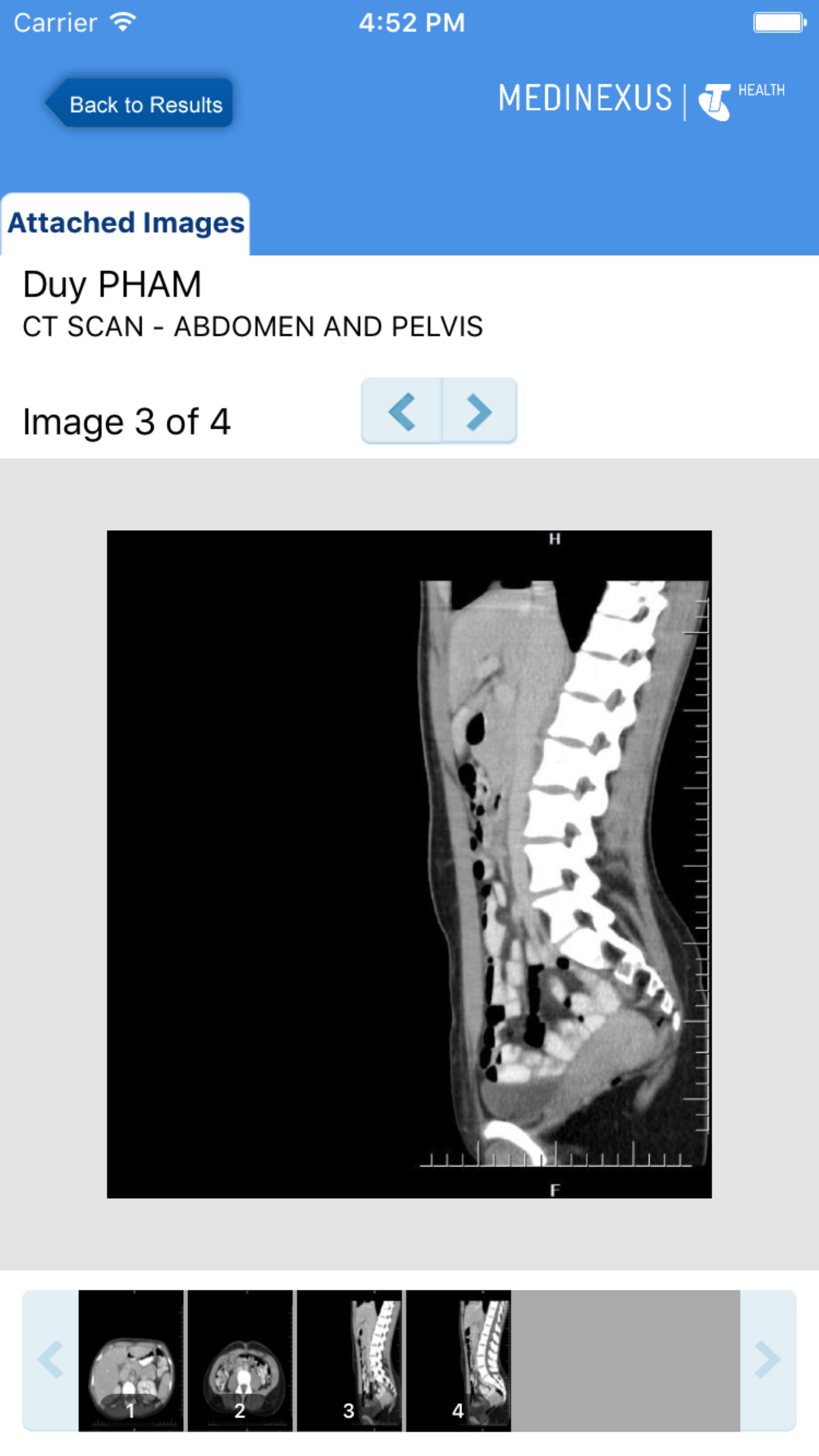 Medinexus Mobile for Patients screenshot 5