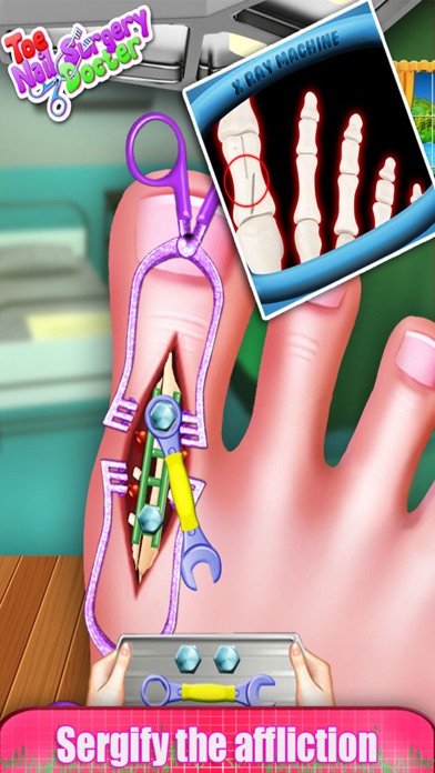Toe Nail Surgery Doctor - free kids games for funのおすすめ画像2