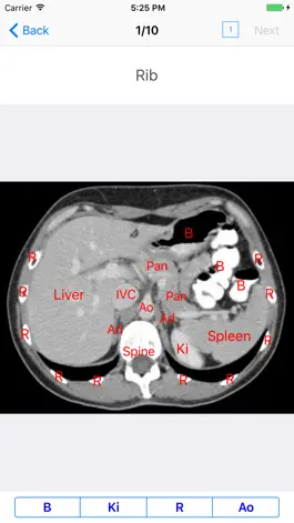 Game screenshot iAnatomy for Patients hack