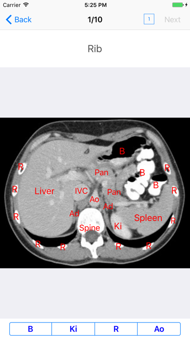 Screenshot #3 pour iAnatomy for Patients