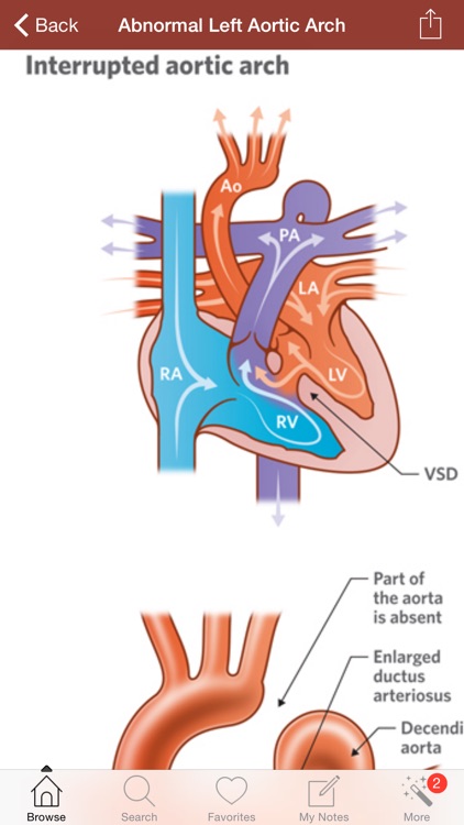 1000 Heart & Coronary Disease