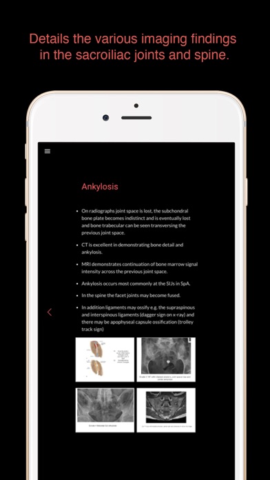 How to cancel & delete ESIMR: UnRavelling Spondyloarthropathy from iphone & ipad 2
