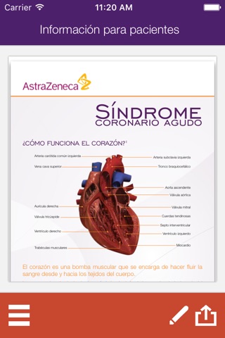 Atlas anatómico interactivo Síndrome coronario agudo screenshot 3