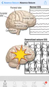 1000 Neurology Medical Dictionary screenshot #1 for iPhone