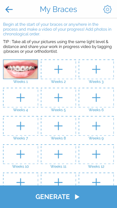 @braces iPhone screenshot