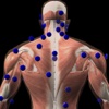 3D Trigger Points