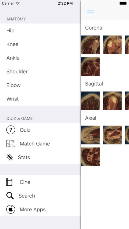 iJoints screenshot-4