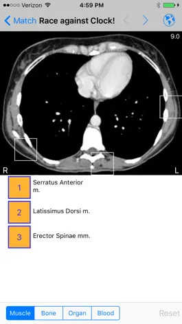 Game screenshot iAnatomy hack