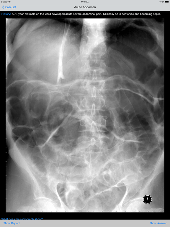 Screenshot #5 pour Xrays4Medics