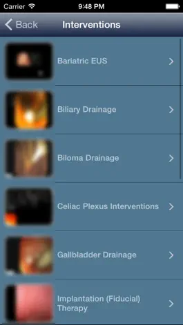 Game screenshot EUS - Diagnostic and Interventional Endoscopic Ultrasound hack