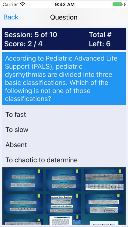 Pediatric Advance Life Support (PALS) Review screenshot-4