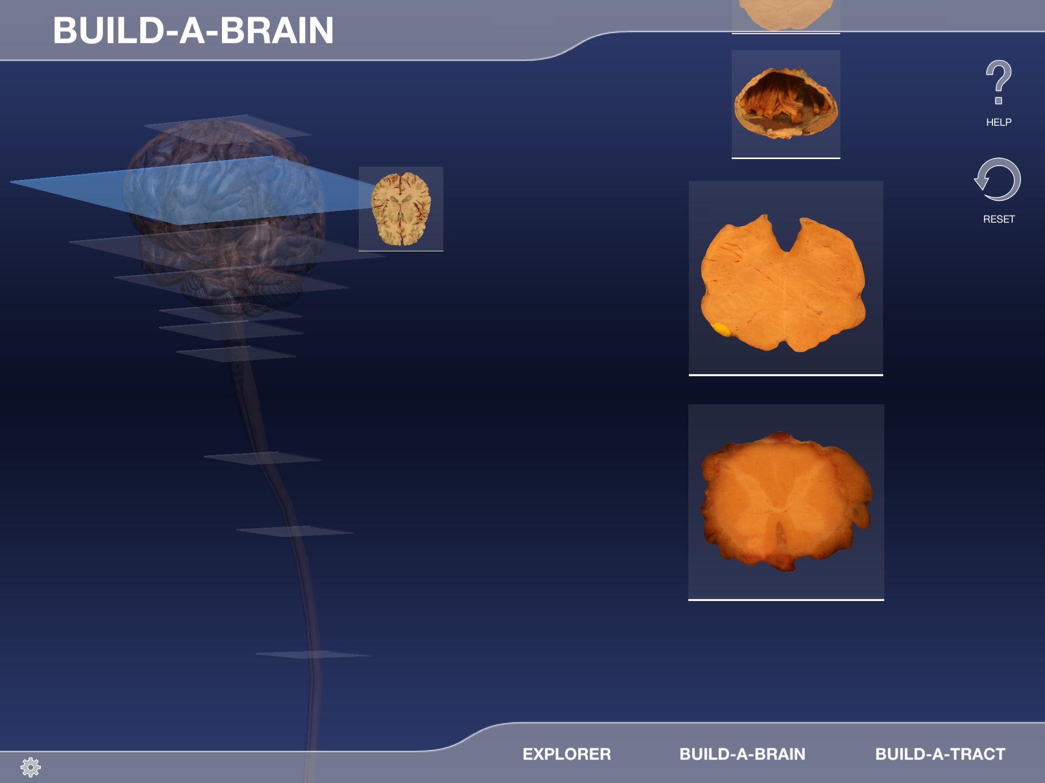 Build-A-Brain Explorer screenshot 3