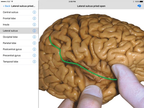 Nolte’s Digital Human Brain screenshot 3