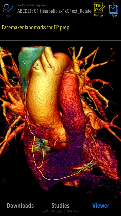MedVizi Medical Imaging