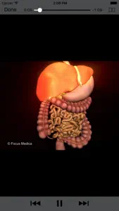 Gastroenterology - Understanding Disease screenshot #4 for iPhone