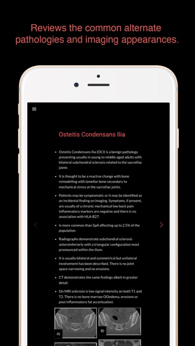 Screenshot #1 pour ESIMR: UnRavelling Spondyloarthropathy